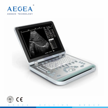 popularity priced AG-BU007 15 inch TFT screen hospital portable doppler ultrasound machine